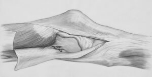 Joint Degeneration in Aging Populations Causes, Symptoms, and Preventative Strategies